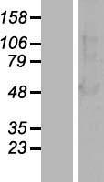 ls000408 beta arrestin 1 arrb1 human over expression lysates nm 004041 wb testing 1