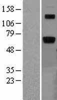 ls000411 arsb human over expression lysates nm 000046 wb testing 1