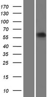 ls000415 arsl human over expression lysates nm 000047 wb testing 1