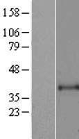 ls000417 art1 human over expression lysates nm 004314 wb testing 1