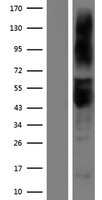 ls000419 art3 human over expression lysates nm 001130016 wb testing 1