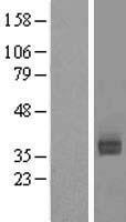 ls000433 asialoglycoprotein receptor 2 asgr2 human over expression lysates nm 080913 wb testing 2