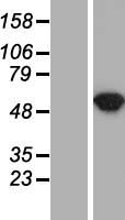 Argininosuccinate Lyase (ASL) Human Over-expression Lysates NM_000048