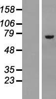 Asparagine synthetase (ASNS) Human Over-expression Lysates NM_001673