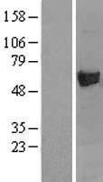 Asparagine synthetase (ASNS) Human Over-expression Lysates NM_133436