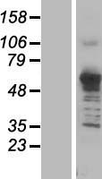 Asparagine synthetase (ASNS) Human Over-expression Lysates NM_183356