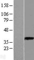 ls000443 aspa human over expression lysates nm 001128085 wb testing 2