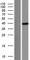 Aspartate beta hydroxylase (ASPH) Human Over-expression Lysates NM_001164752