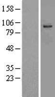 Aspartate beta hydroxylase (ASPH) Human Over-expression Lysates NM_004318