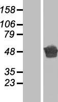 Aspartate beta hydroxylase (ASPH) Human Over-expression Lysates NM_032466