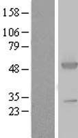 ls000445 ass1 human over expression lysates nm 000050 wb testing 1