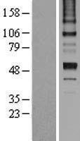 Antithrombin III (SERPINC1) Human Over-expression Lysates NM_000488