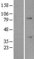 ATF1 Human Over-expression Lysates NM_005171