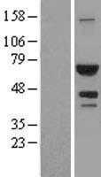 ATIC Human Over-expression Lysates NM_004044