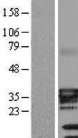 ATP1B3 Human Over-expression Lysates NM_001679