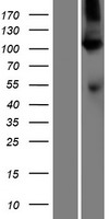 ATP2A1 Human Over-expression Lysates NM_173201