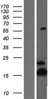 ls000513 atp5f1d human over expression lysates nm 001001975 wb testing 2