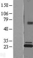 ATP5PB Human Over-expression Lysates NM_001688
