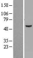 ATP6V1B1 Human Over-expression Lysates NM_001692