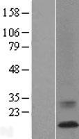 ls000527 atp6v0c human over expression lysates nm 001694 wb testing 1