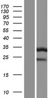 ATP6V1E1 Human Over-expression Lysates NM_001039367