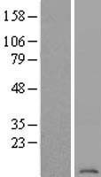 ls000534 atp6v1g2 human over expression lysates nm 138282 wb testing 1