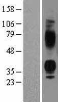 Vasopressin V1b receptor (AVPR1B) Human Over-expression Lysates NM_000707