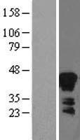 Zinc Alpha 2 Glycoprotein (AZGP1) Human Over-expression Lysates NM_001185
