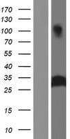 Azurocidin (AZU1) Human Over-expression Lysates NM_001700