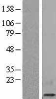 beta 2 Microglobulin (B2M) Human Over-expression Lysates NM_004048