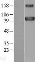 BACH1 Human Over-expression Lysates NM_001186