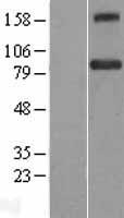 BACH1 Human Over-expression Lysates NM_206866