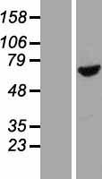 BBS1 Human Over-expression Lysates NM_024649