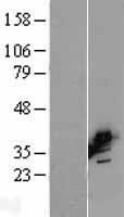 BCAT2 Human Over-expression Lysates NM_001190