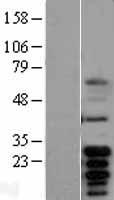 Bcl x (BCL2L1) Human Over-expression Lysates NM_138578