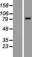 bcl 6 (BCL6) Human Over-expression Lysates NM_001130845