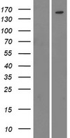 BCR Human Over-expression Lysates NM_021574
