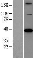 BCS1L Human Over-expression Lysates NM_004328