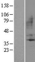 BDKRB1 Human Over-expression Lysates NM_000710