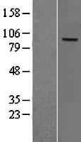 Complement factor B (CFB) Human Over-expression Lysates NM_001710