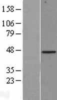 Biglycan (BGN) Human Over-expression Lysates NM_001711