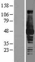 BHMT Human Over-expression Lysates NM_001713