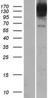 BICD1 Human Over-expression Lysates NM_001714