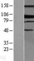 PRDM1 Human Over-expression Lysates NM_001198