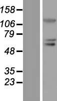 PRDM1 Human Over-expression Lysates NM_182907