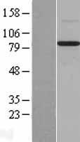 BMP1 Human Over-expression Lysates NM_001199