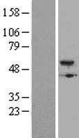 BMP5 Human Over-expression Lysates NM_021073