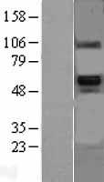 BMP6 Human Over-expression Lysates NM_001718