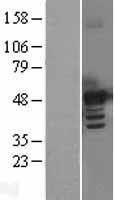 BMP7 Human Over-expression Lysates NM_001719