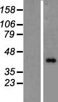 BMP8B Human Over-expression Lysates NM_001720